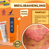 Salep Ampuh Mengobati Jamur Kulit,Iritasi Pada Kulit,Infeski Kulit,Salep Meilibahenling Atasi Masala