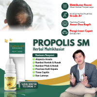 Propolis SM Obat Pitak, Alopecia Areata, Atasi Rambut Rontok Dan Rusak, Penumbuh Rambut Pitak, Peraw