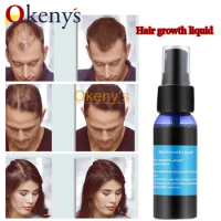 4pcs 30ml Ginger Hair Growth Spray Yuda Pilatory Faster Hair Growth Products for Men and Woman Special for Postpartum Hair Loss