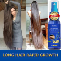 Ginger Hair Growth spray Anti Hair Fall Hair Loss Treatment Hair Growth Essence Oil for Men Women hair treatment