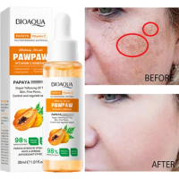 30ml Papaya Freckle Whitening Serum Vitamin C Dark Spots Removal Pigment Melanin Correcting Facial Serum Anti-wrinkle Skin Care