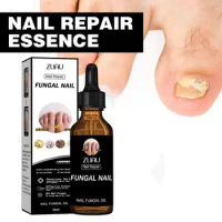 Nail Fungus Treatment Essence Anti Infection Paronychia Foot 30ml Fungal Onychomycosis Care Removal Repair Hand Nourishing V7B1