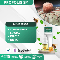 Propolis SM Tumor Jinak, Benjolan Tumor, Keloid, Lipoma, Tumor Neuroma, Tumor Kelenjar, Mioma, Tumor