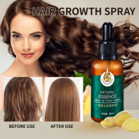 Hair Growth Anti-off Essential Oil Spray Hair Growth Spray Nourish Thick Roots Repair Dry Hair Repair Damage Hair Promotes 30ml