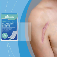 Hydrogel Transparent Scar Patch Care For Ones Relieve Redness Itching Discreet Silicone Scar Sheet