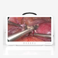 Portable Medical Laparoscopy Gynecology Urology ENT Orthopedics HD Endoscope Camera With Monitor 22inch 24inch 27inch 32inch