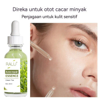 Traditional Herbal Acne Treatment Cream 30g Repair Acne Fade Acne Oil Control Brighten Fade Root Pro