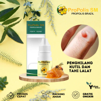 Cairan Herbal Oles Untuk Menghilangkan kutil dan tahi lalat di leher, di tangan, di kaki, di seluruh