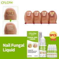 Fungal Nail Treatment Liquid Nail Repair Paronychia Anti Infection Solution Toe Fungus Removal Onychomycosis Cleaner Foot Care