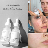 Face Skin Care Alpha Arbutin 2% Ha Essence Lighten Improve Dark Spots Brighten Whitening Moisturizing Essence Repair Skin Acne