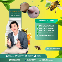 Propolis SM Untuk Kutil dan Tahi Lalat, Penghilang Kutil Di Wajah Papiloma Kutil Di Leher, Penghilan
