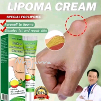 LIPOMA KRIM BENJOLAN jinak Benjolan leher