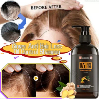 Ginger Anti-hair Loss Shampoo Promotes Hair Follicle Growth, Improves Hair Loss and Controls Oil, Natural Herbal Shampoo 300ml