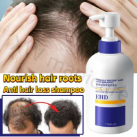 EHD Anti-hair Loss Solid Shampoo Oil Control Fluffy Anti-dandruff Ginger Shampoo Refreshing and Smooth Men's and Women's Shampoo