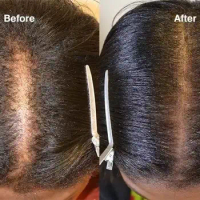 30ml Nourishing Hair Lotion Helps Hair Growth Scalp Essence Hair Care Spray Hair Growth Products Hair Care Hair Growth Oil
