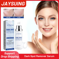 Dark Spot Remover Serum for Face Anti Freckle Lighten Melasma Fade Pigment Melanin Correcting Whitening Moisturizing Skin Care