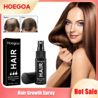 Hair Growth Spray Anti Hair Loss Fast Regrowth Scalp Damaged Treatment Repair Nourish Roots Prevent Baldness Hair Dense Liquid