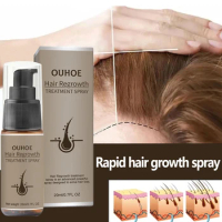 Powerful Hair Growth Serum Spray Effective Baldness Repair Hereditary Hair Loss Seborrheic Hair Anti Loss Fast Regrowth