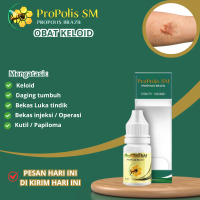 Salep bekas luka, penghilang bekas luka keloid, Salep penghilang luka bekas , Penghilang stretch pad
