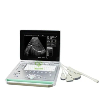 MY-A009 New hospital medical 3d transvaginal machine portable pregnancy ultrasound scanner