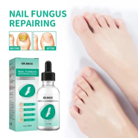 30ml Nail Fungal Treatment Feet Care Essence Anti Infection Paronychia Onychomycosis Foot Toe Nail Fungus Removal repair serum