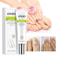 Sdottor Fungal Nail Gel Treatment Feet Care cream Anti Infection Paronychia Ingrown toenail Repair Foot Toe for Nails Fungus Rem