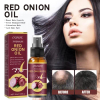 Onion Black Seed Hair Oil Spray Hair Care Growth