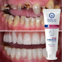 Quickly Repair Gums Decay Cavities Caries Toothpaste Protect Teeth Whitening Remove Plaque Eliminate Bad Breath Teeth Care