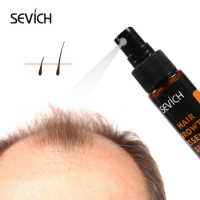 Sevich 30ml Hair Growth Essential Oil Hair Loss Product Anti Hair Loss Treatment Hair Growth Essence Spray Original Authentic