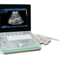 15 in LED screen notebook ultrasound free shipping