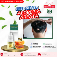 Propolis SM Untuk Rambut Rontok dan Rusak, Alopecia areata, penumbuh rambut pitak, botak koin, Peraw