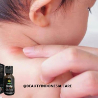 OILIFE - Minyak Oles Benjolan Di Leher Ampuh Original BPOM