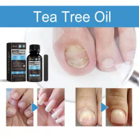 Healthy Toenail Treatment Natural Extra Strength Nail Fungus Treatment Solution for Healthy Toenail Fingernails Repair Renew