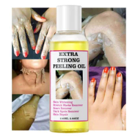 Extra Strength Yellow Peeling Oil Knuckles Skin Whitening Remove Dead Skin Exfoliating Anti Dark Spots Oil 30ml 100ml