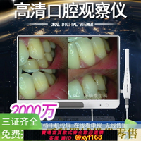 {台灣公司貨 可打統編}大得DA600口腔內窺鏡牙科觀察儀wif19寸一體機手機投屏在線看電視