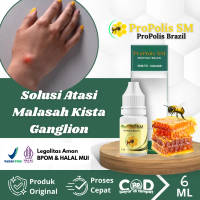 Suplemen Untuk Kista Ganglion, Benjolan Di Tangan, Tumor Jinak, Benjolan Lipoma Dengan ProPolis SM -