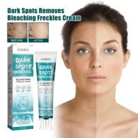 Eelhoe Whitening Spot Cream Moisture Replenishment Skin Spot Fading Acne Whitening Brightening Skin Rejuvenation Skin Cream