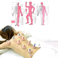 BỘ GIÁC HƠI CHÂN KHÔNG 12 CỐC