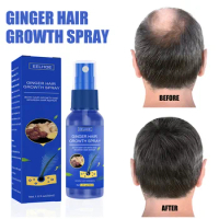 Anti-hair Loss Hair Growth Spray Scalp Massage Moisturizing Thick Hair Care Anti Hair Loss Strengthen Hair Roots Nutrient Sprays