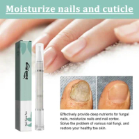 Sdatter4ml Nail Fungal Treatment Pen Infection Foot Paronychia Removal Toe Onychomycosis Feet Care Treatment Toenails Infection