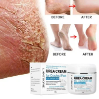 Cleft Foot Urea Cream Split Foot Urea Cream Anti-Drying Feet Ointment Heel Cracked Repair Removal Dead Skin Moisturizing Cream