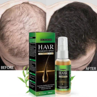 Ginger Hair Growth Essential Oil Fast Hair Growth Serum Spray Prevent Anti Hair Loss Scalp Treatments Beauty Health Hair Care