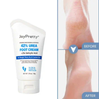 Revitalizing Urea Foot Cream Quick Effect Deep Moisture Skin Repair Amp Rejuvenation For Healthy Feet Suitable For Dry Seasons