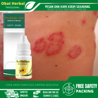 Salep Kurap, Gatal Kulit, Penghilang Kurap, Penghilang Panu, Gatel Exim Kulit, Antibakteri Kurap Pan