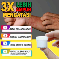 Bisa COD krim racikan dokter spesialis kulit untuk eksim scabies psoriasis dan gatal slengki isi 10g