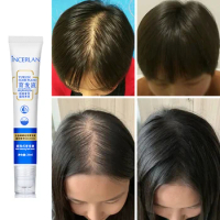 Hair Growth Products Biotin Fast Growing Hair Care Essential Hair Growth Solution Anti Hair Loss Spray Scalp Treatment