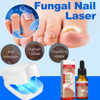 Fungal Nail Laser Device Anti Infection Paronychia Onychomycosis Ingrown Toenail Foot Care Essence Repair Fingernail Fungus