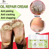 Flow Week Urea Cream Hand Foot Cream Callus Remover Salicylic Acid Moisturizing Anti-dry Heel Cracked Repair Cream Feet Care