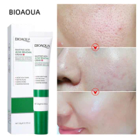20G Salicylic Acid Acne Removal Cream Shrink Pores Refining Cream Blackhead Remover Anti-aging Oil Skin Care Korean Products