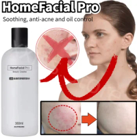 HomeFacial Pro Calendula Soothing Toner Oil Control Shrink Pores Hydrating Soothing Acne Oil Control 380ML